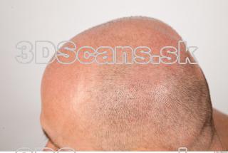 Hair texture of Dale 0007